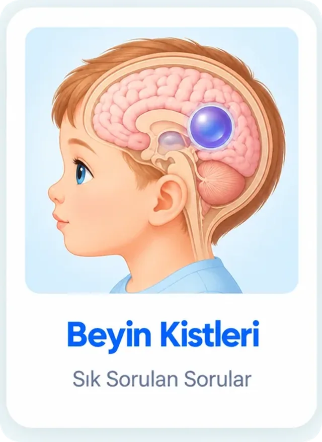brain_cyst